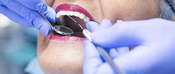 Best Emergency Dental Surgery in Sangaree, SC